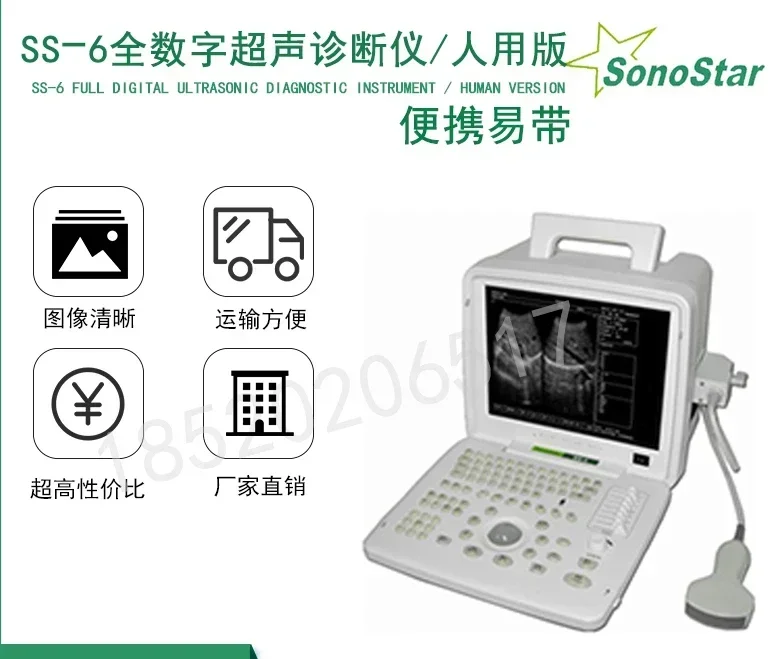 Portable B-ultrasound machine for human use. B-ultrasound machine Mindray DP-10, same model as outpatient standard with SS6