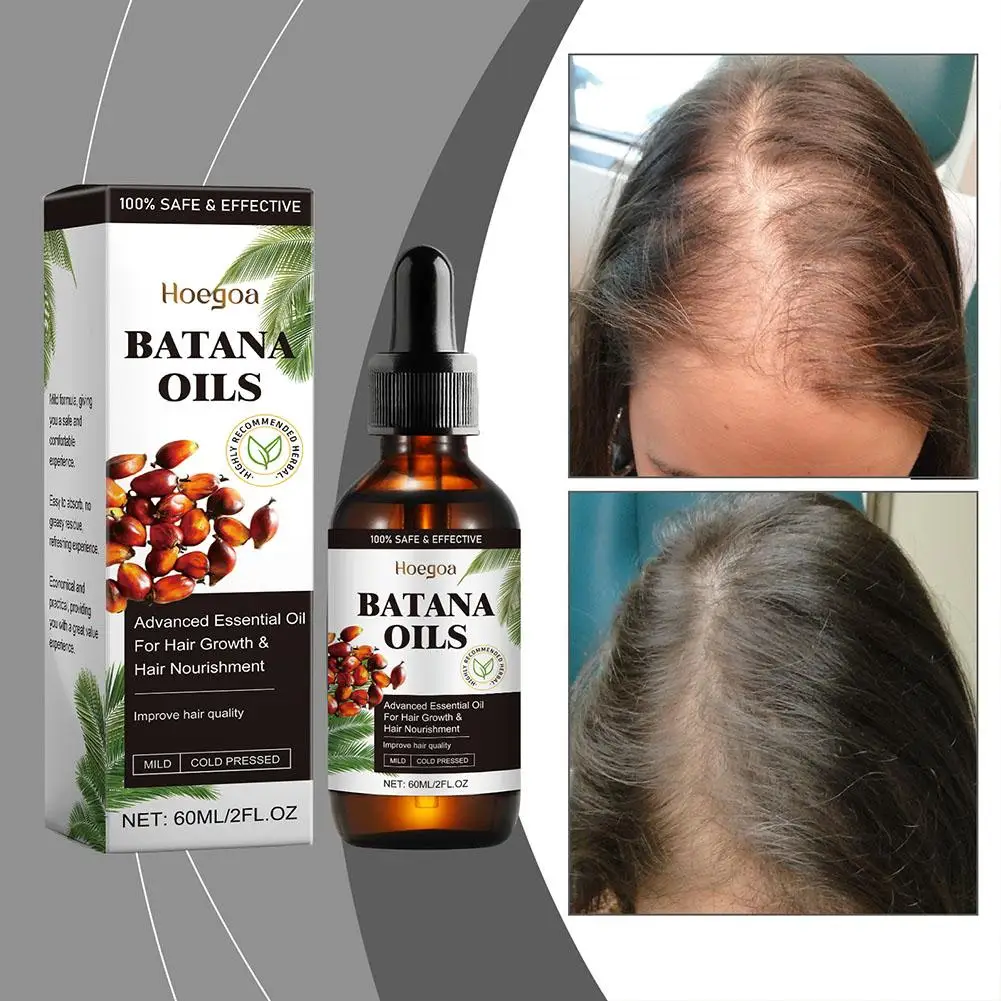 60ml Batana Oil Hair Regrowth หัวล้านน้ํามัน Organic Batana Oil Hair Care Anti Break Loss Oil Hair Care