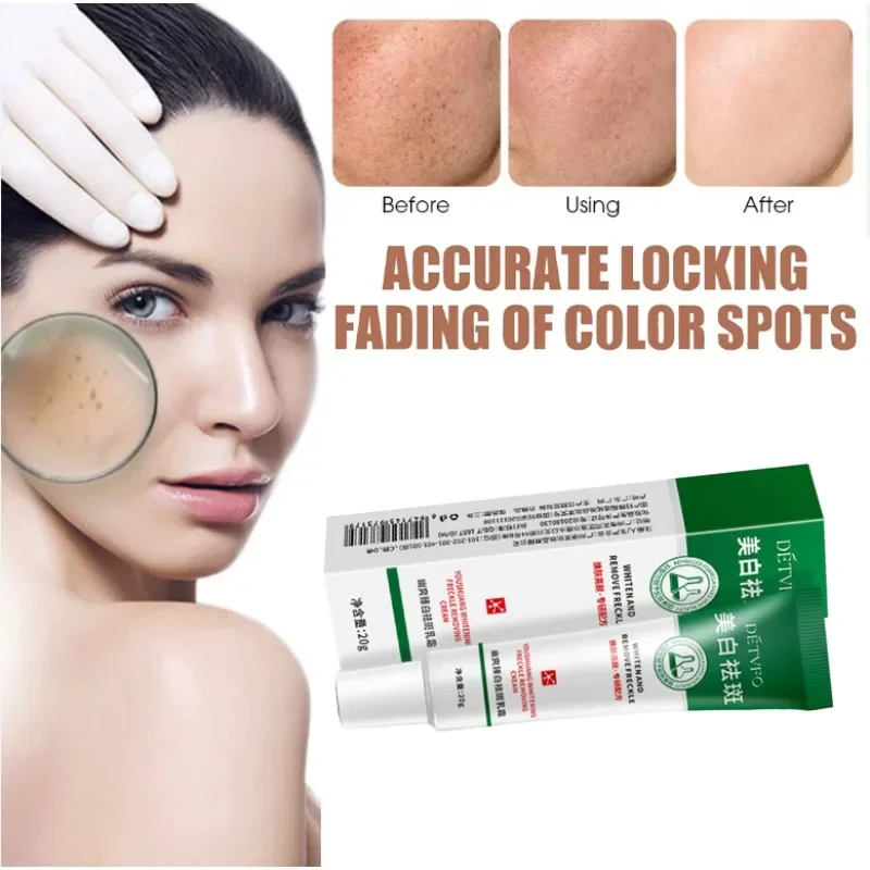 

Whitening Freckle Cream Effective Remove Melasma Cream Remove Dark Spots Melanin Moisturize Brighten Smooth Face Skin Care