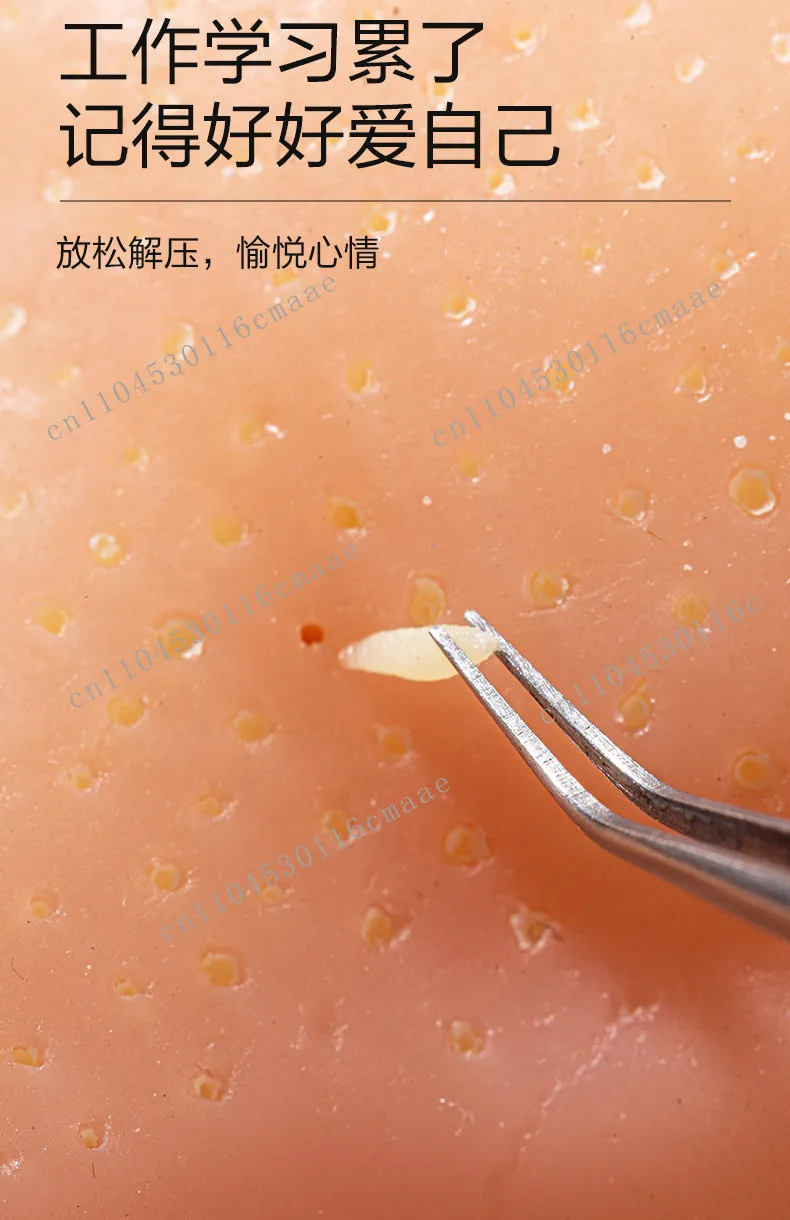 Stress Relief Products Strawberry Nose Pimple Popping Toy - Blackhead Extraction Stress Relief Fidget Model