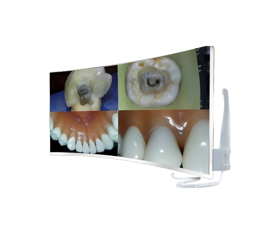 

M-988A II Intraoral Camera+23.8 Inch Ultra 4K HD LED Monitor Smart Focus All-in-one Oral Observation Device