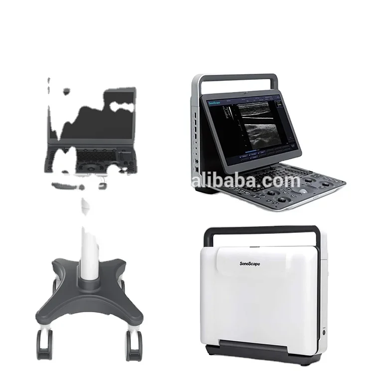 B/W  Medical Ultrasound Super hot sales B/W Ultrasound Sonoscape E1 Portable