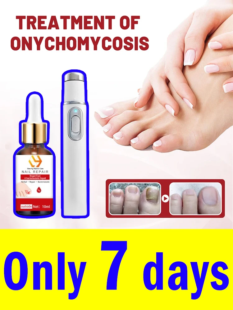 Fungal Nail Laser Device Repair Fast Nails Fungus Onychomycosis