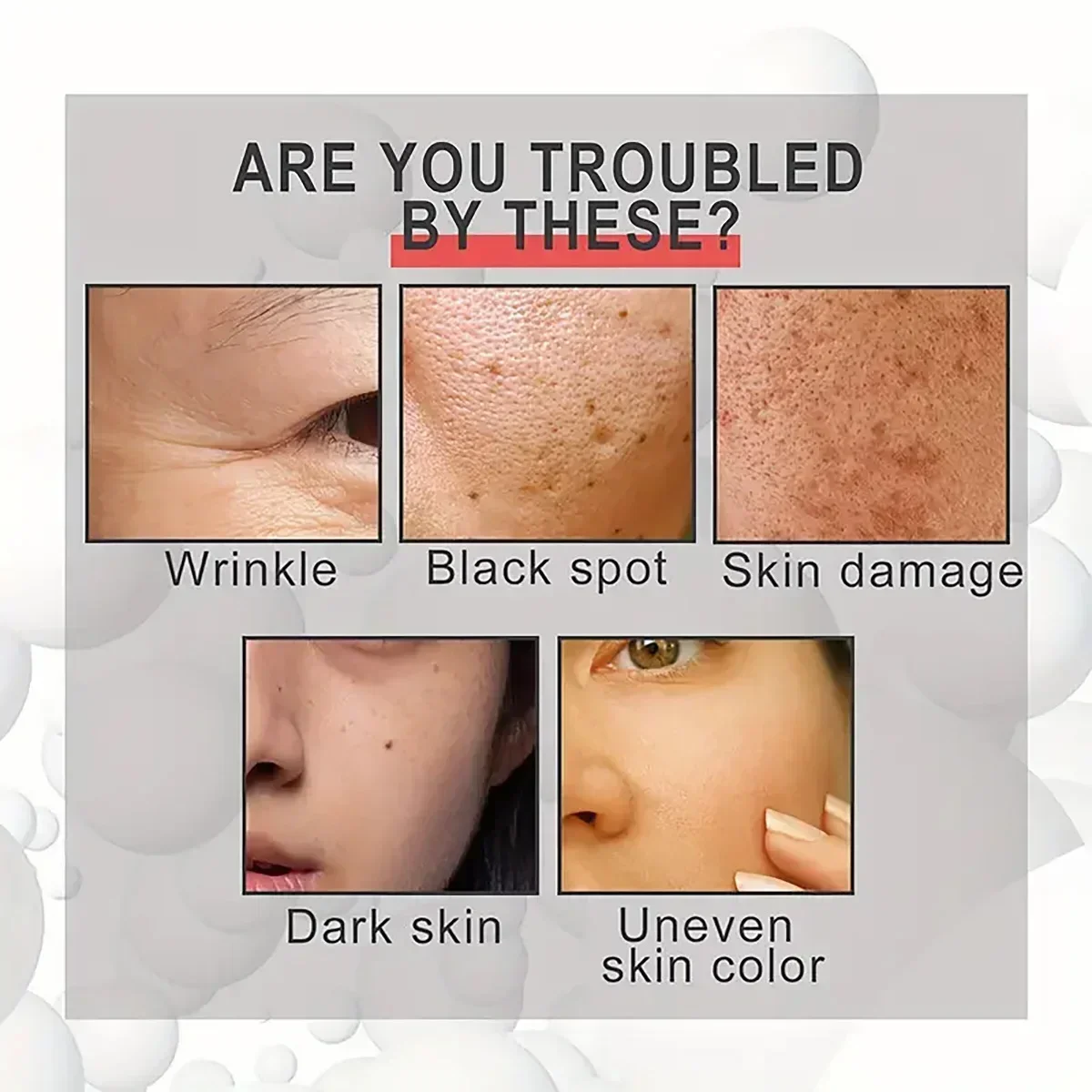 38Skincare Deep clear spots, skin rejuvenation - natural ingredients freckle cream, goodbye spots trouble