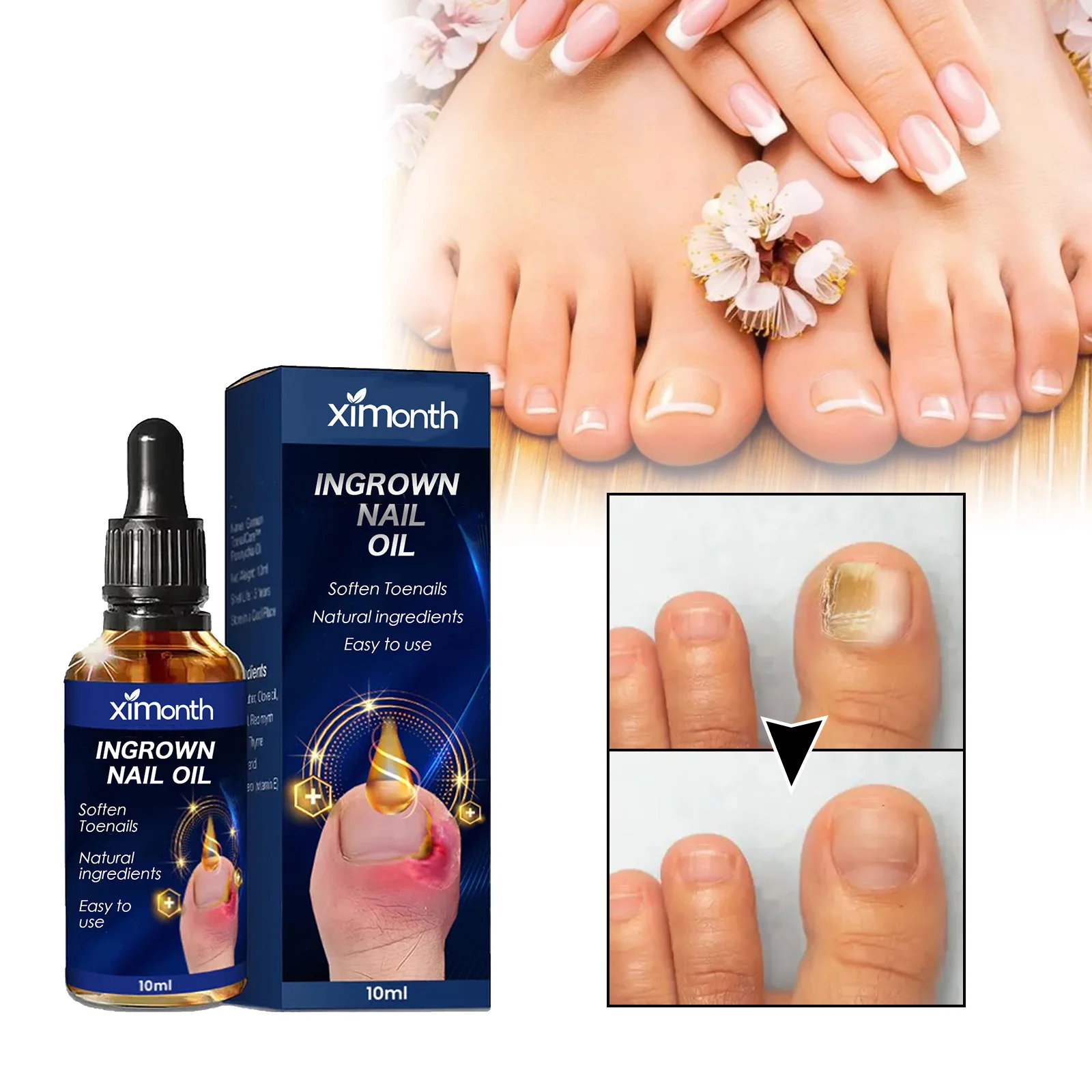 Nail Fungals Renewal Nail Repair Liquid for Discolored Thickened Crumbled Nails Nail Fungals for Discolored Broken Cracked S5F80