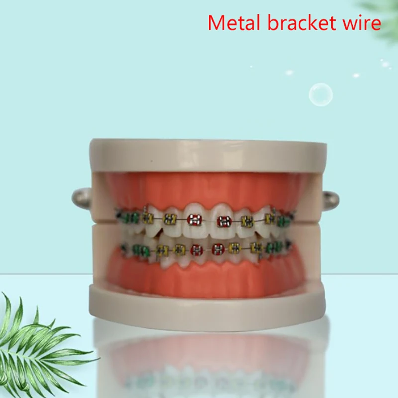 1 Pair Temporary Tooth Decoration With Metal Wires Colorful Metal Bracket And Orthodontic Ligature Ties Dental Decorations