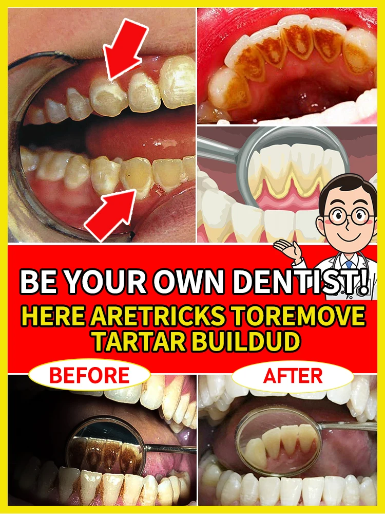 

Clean up dental stones, freshen breath, whiten teeth, and show a confident smile