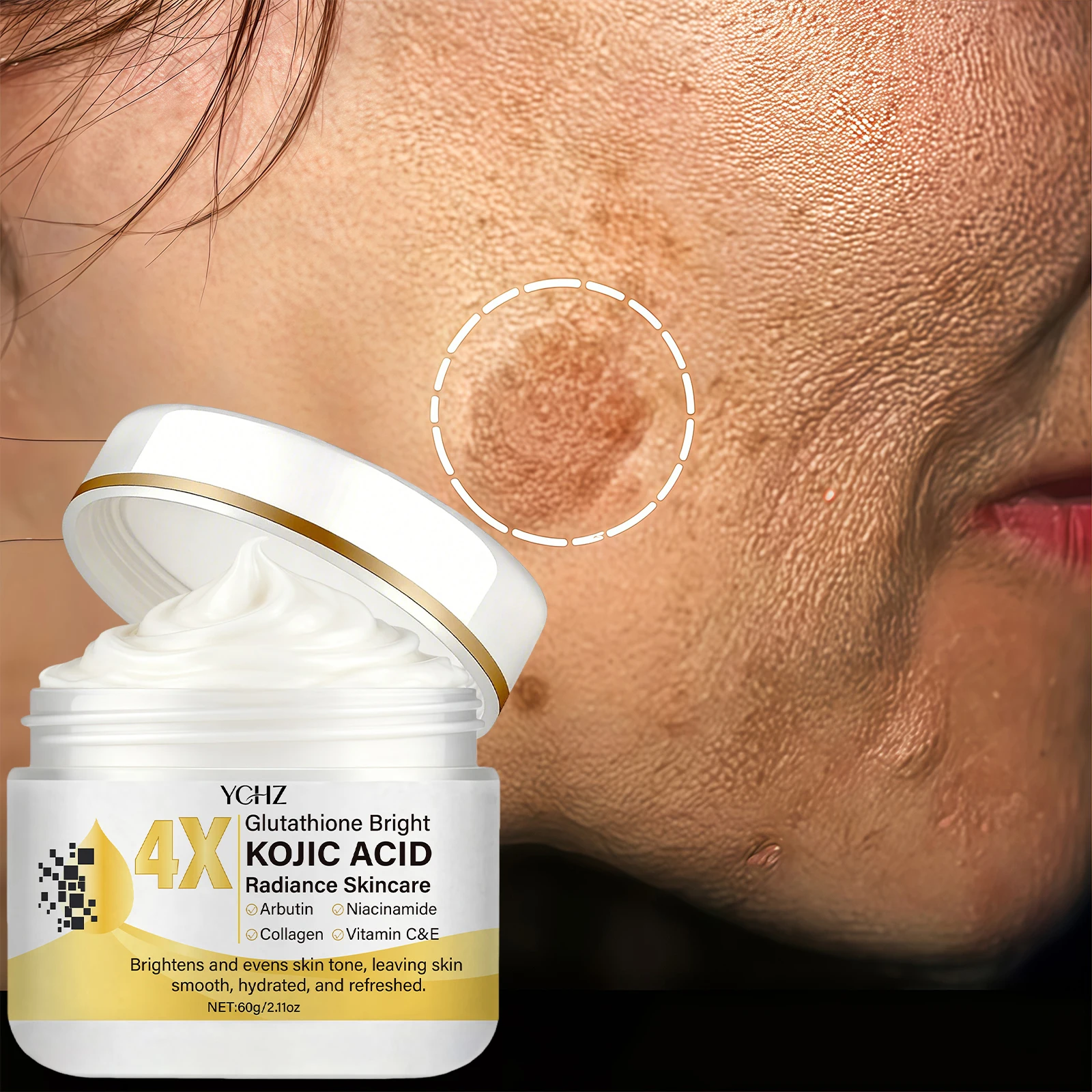 Crema facial con ácido kójico, unifica el tono de la piel, elimina las manchas oscuras y la opacidad - No grasa, adecuada tanto para hombres como para mujeres - Crema blanqueadora e hidratante, para uso diurno y nocturno - 60 g