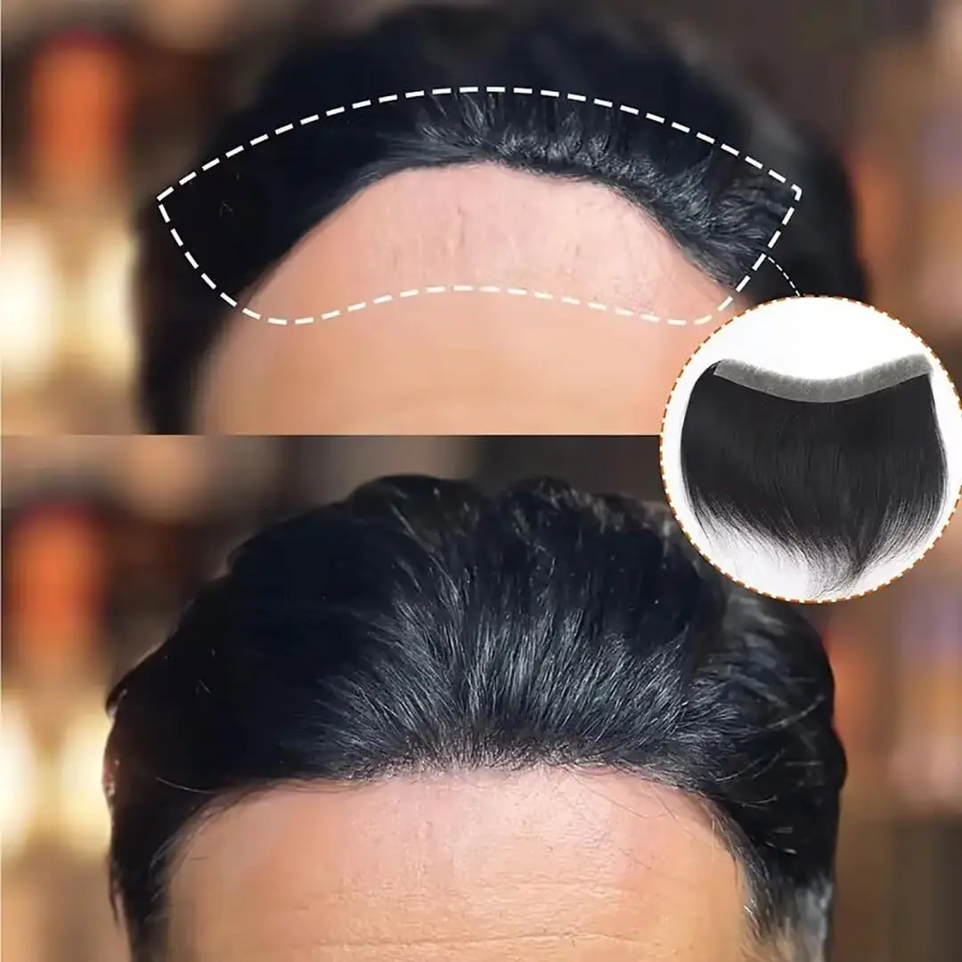 patch-frontal-pour-homme-en-pu-ultra-fin-100-cheveux-humains-sans-trace-pour-la-remplacement-de-la-ligne-de-cheveux