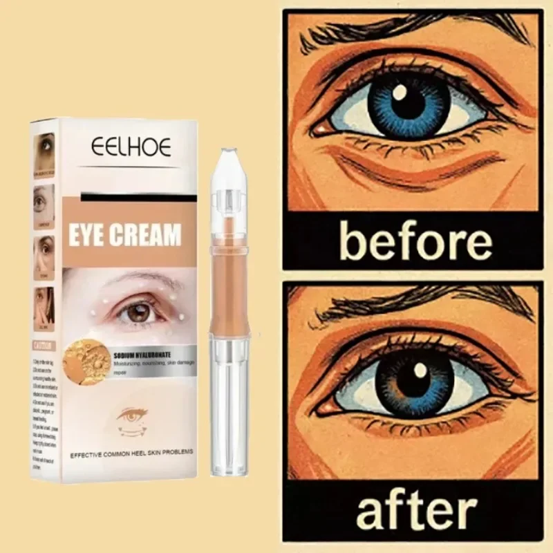 Eye Cream Removing Dark Circles Wrinkle Lightening Fine Lines Moisturizing Whitening Skin Care Remove Eye Bag Sti