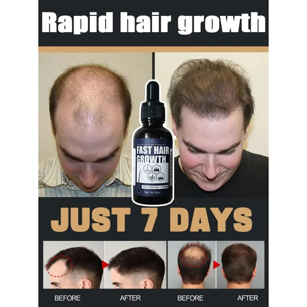 

Faster Stronger Thicker Hair Growth | Clinically Tested for Thicker Hair | Rapid hair growth