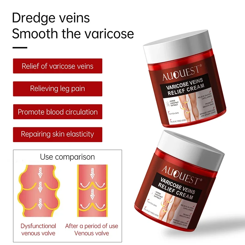 Effective Varicose Vein Relief Cream Removal Vasculitis Phlebitis Ointment Legs Dilated Capillaries Tratamiento De Relajación