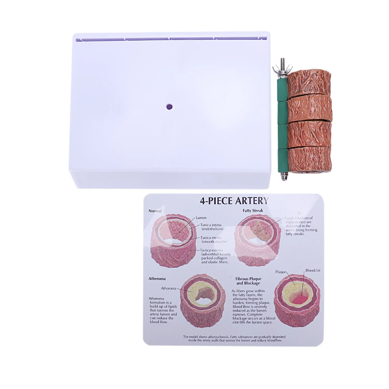 تصلب الشرايين نموذج التخثر أمراض الأوعية الدموية مظاهرة نموذج أمراض الأوعية الدموية على شكل قلب #1