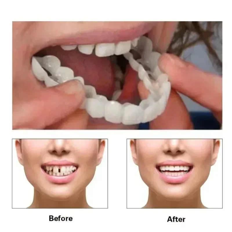 Sdotter capa de dente falso ajuste perfeito clareamento dos dentes snap em silicone sorriso folheados dentes dentaduras flexíveis ferramenta beleza cosme