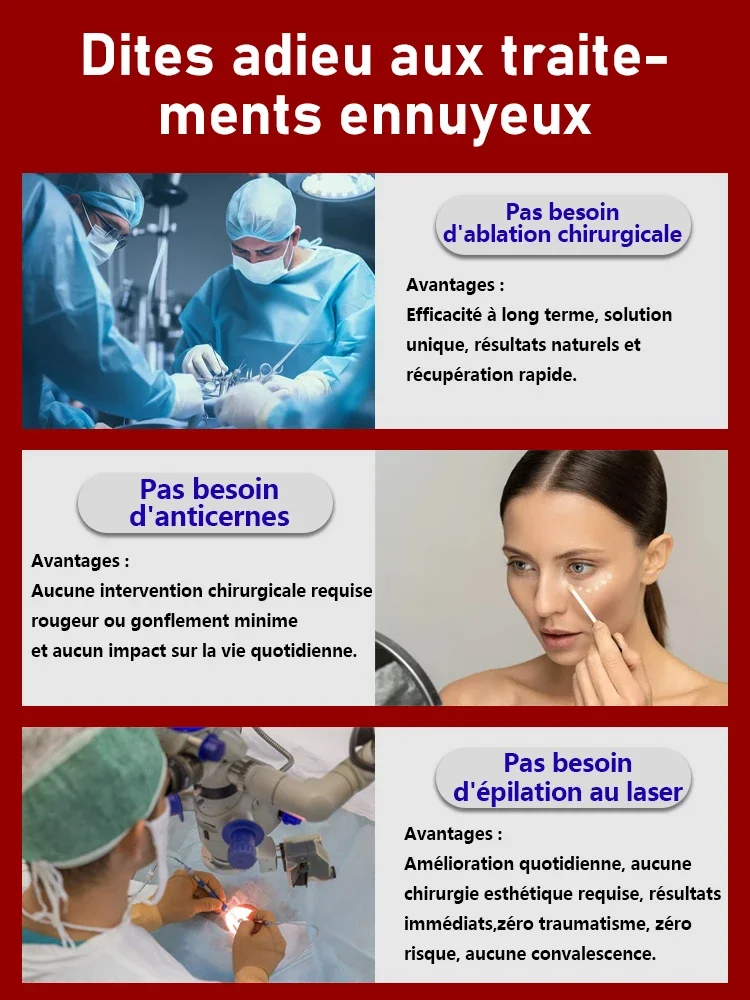 Potente crema per gli occhi: riduce il gonfiore e le occhiaie