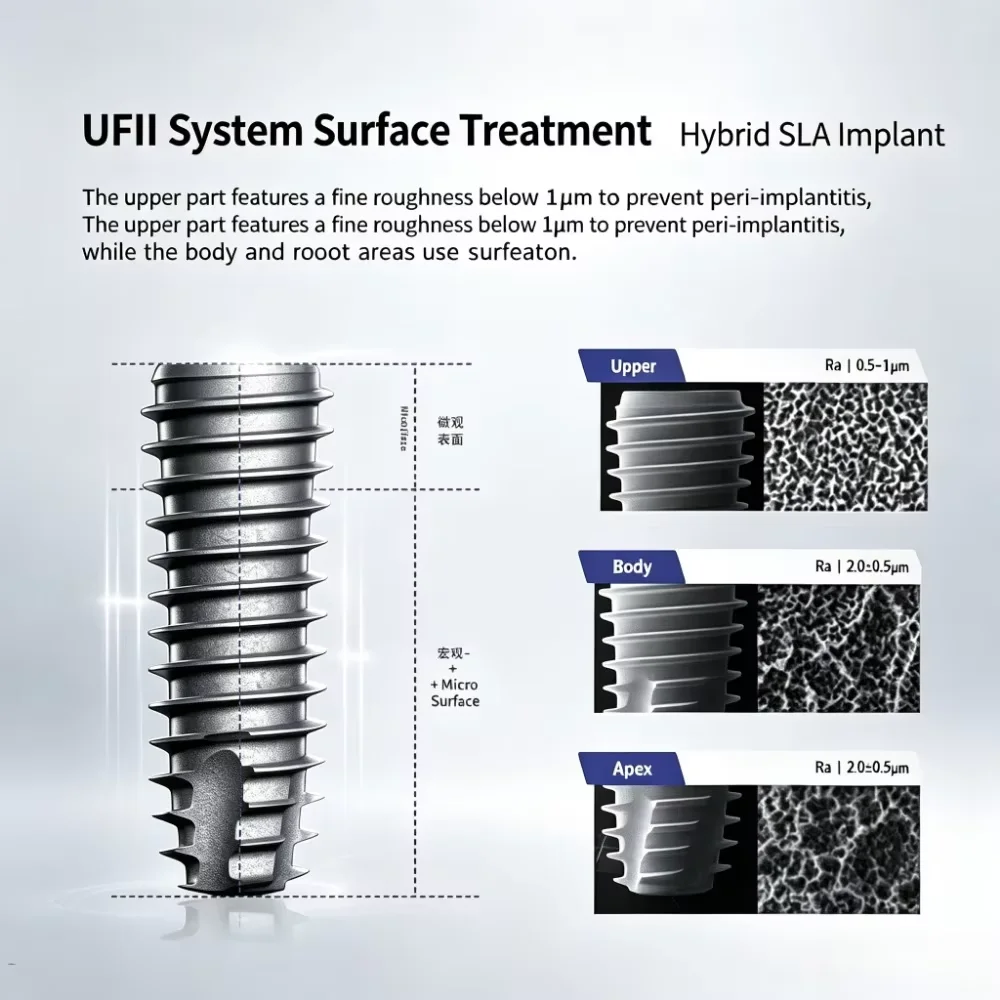 5Pcs Korean UFII universal ultra-light minimalist dental implant system restoration instrument original imported DIO implant
