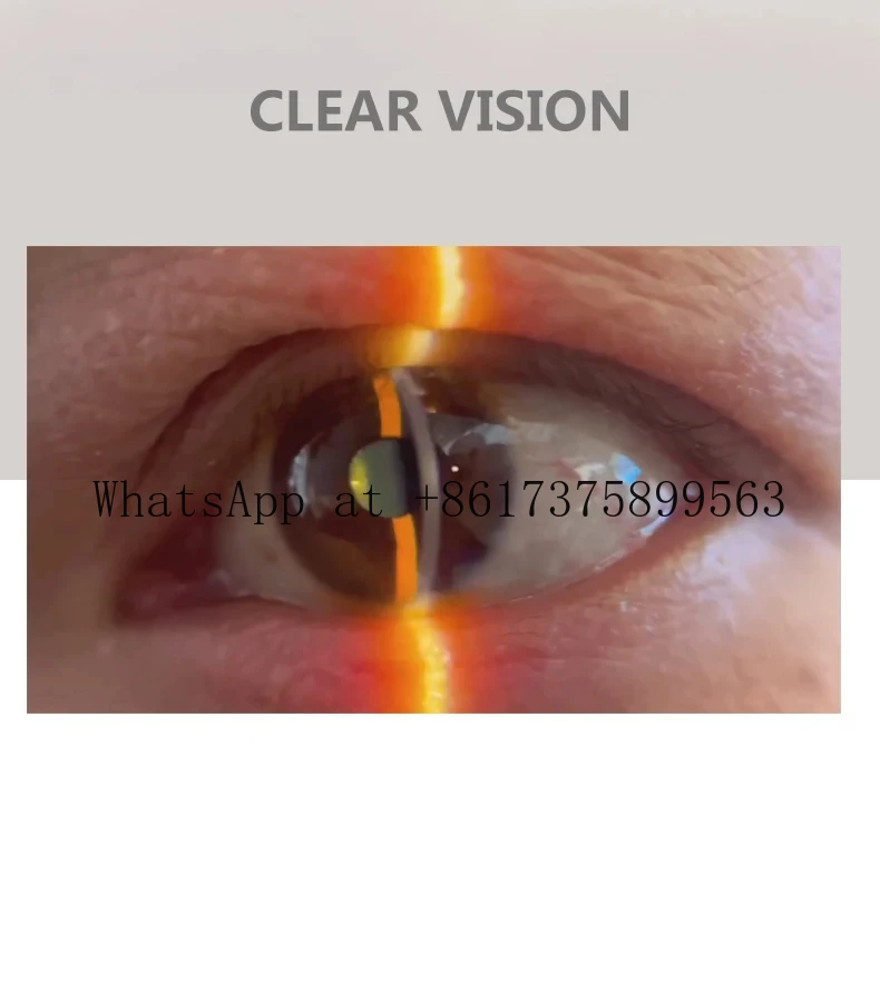 Portable Handheld LED Veterinary Slit Microscope New Vision Professional Pet Ophthalmic Diagnostic Examination Device