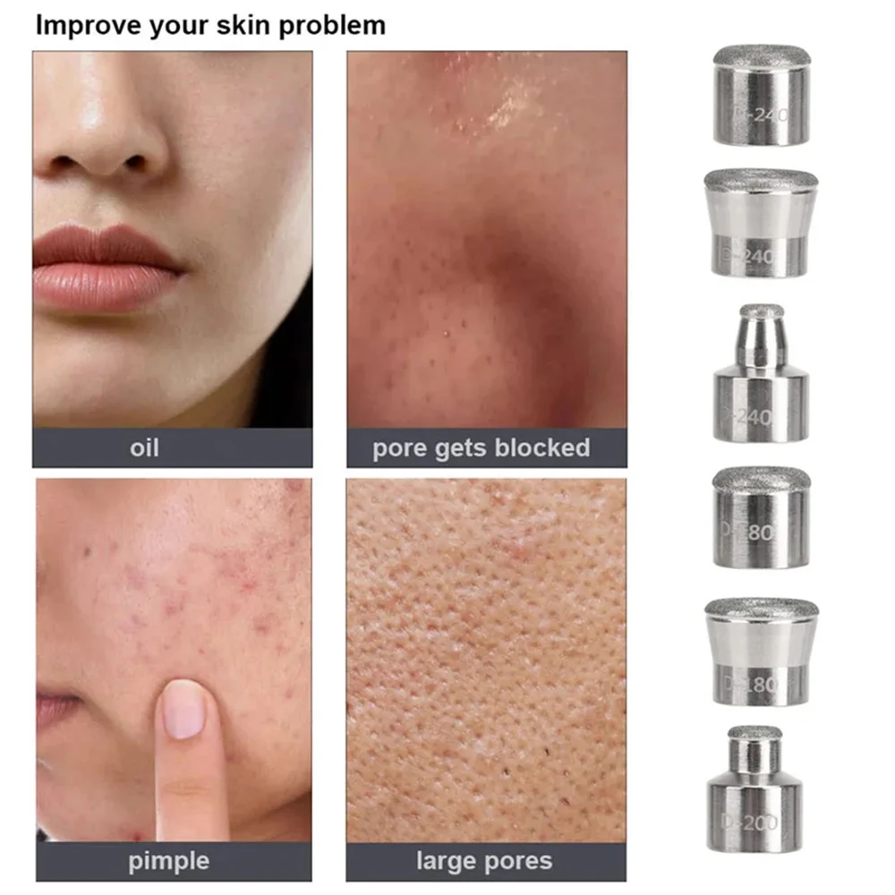 Diamant Microdermabrasion Dermabrasion pointe outils de beauté soins de la peau diamant Dermabrasion pointe de remplacement réparation du visage entretien