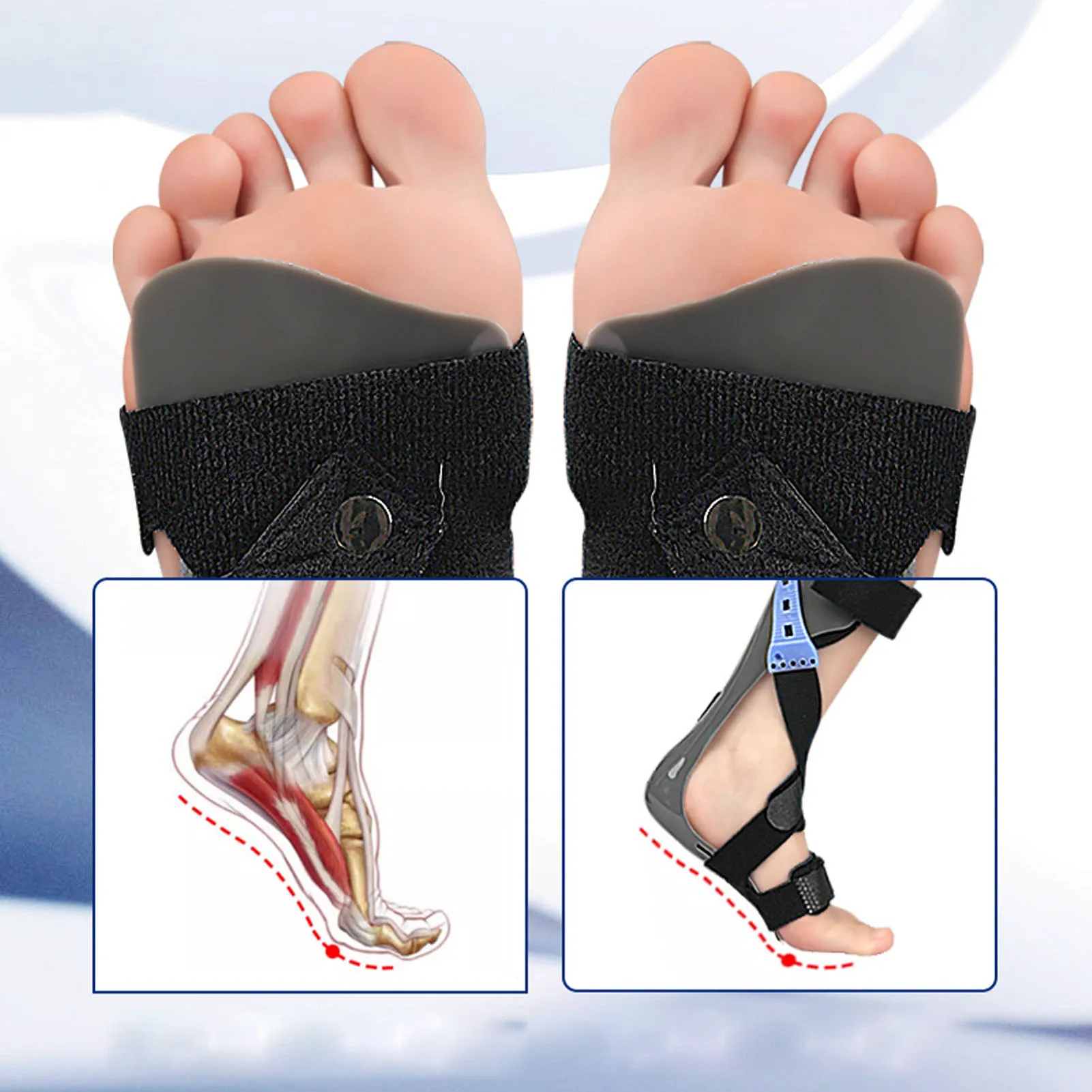 Foot Drop Brace Correct Posture Ankle Orthosis Support Stable Elastic Straps Polypropylene and Nylon for Sleeping for Outdoors