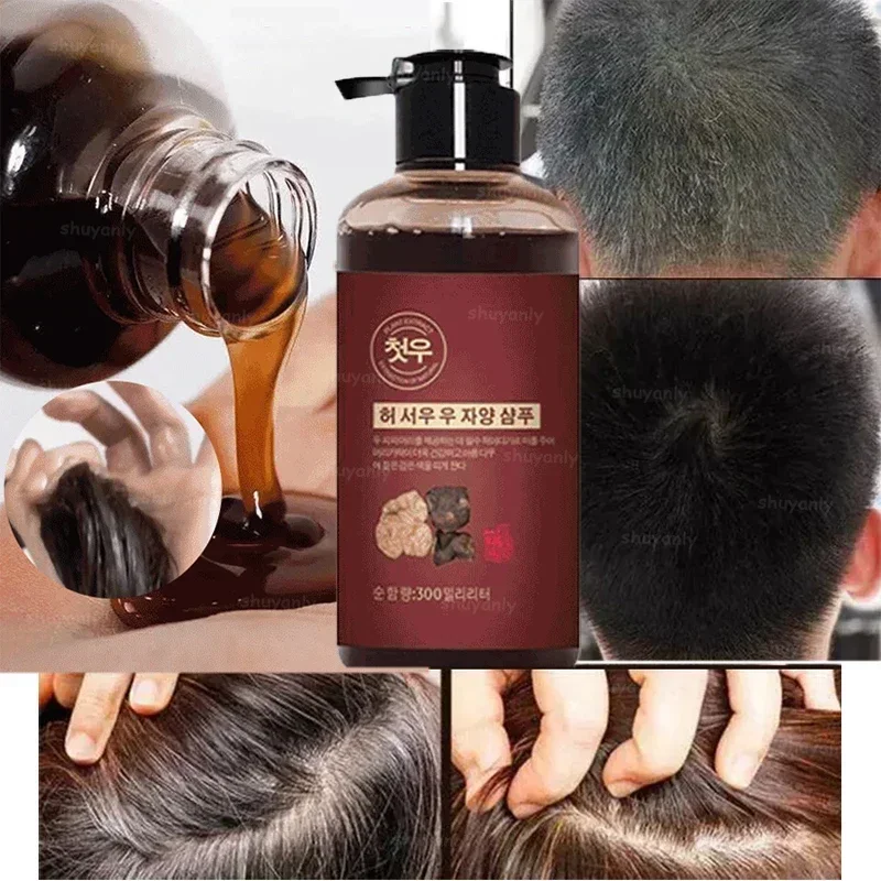 Herbal Natural Polygonum Multiflorum Shampoo Plant Liquid Grey Hair White Hair Removal Turn Permanent Black Hair Care 300ml