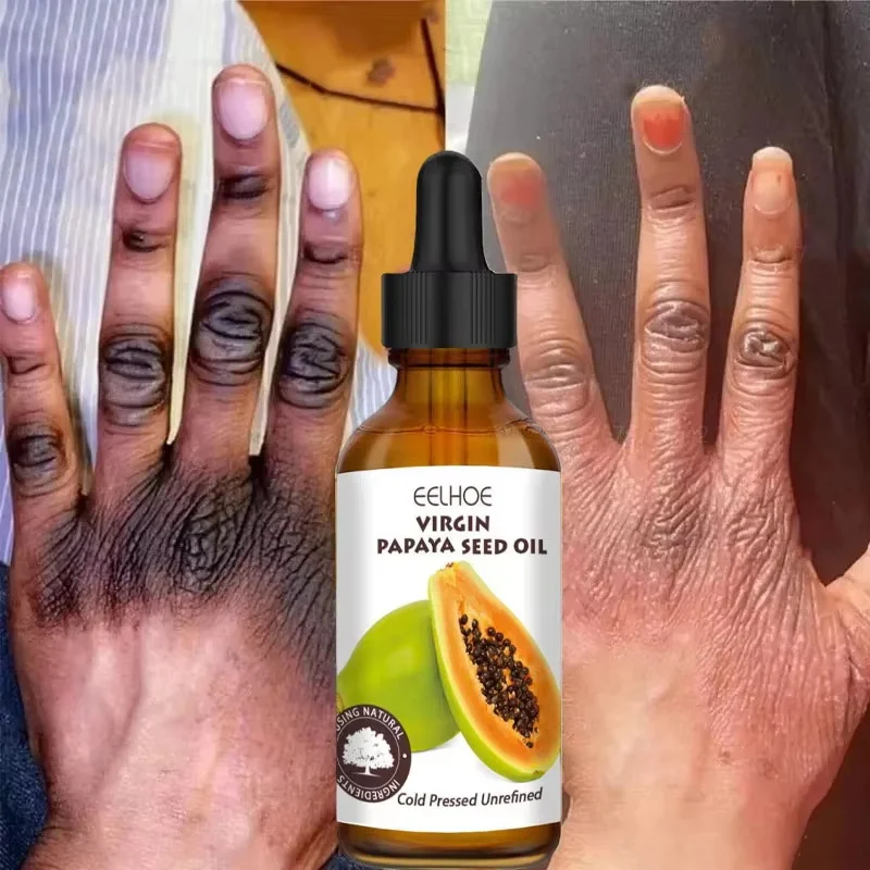 

Dark Knuckles Fast Brighten Serum Elbows Hand Knuckle Brightening Serum Knee Black Skin Quickly Lighten Stains Remover Essence