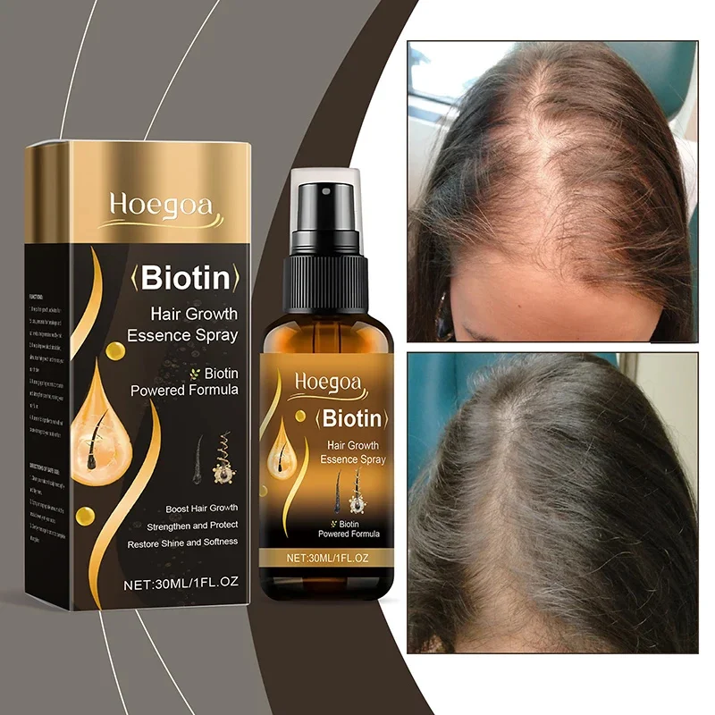 Biotin Hair Growth Spray 6