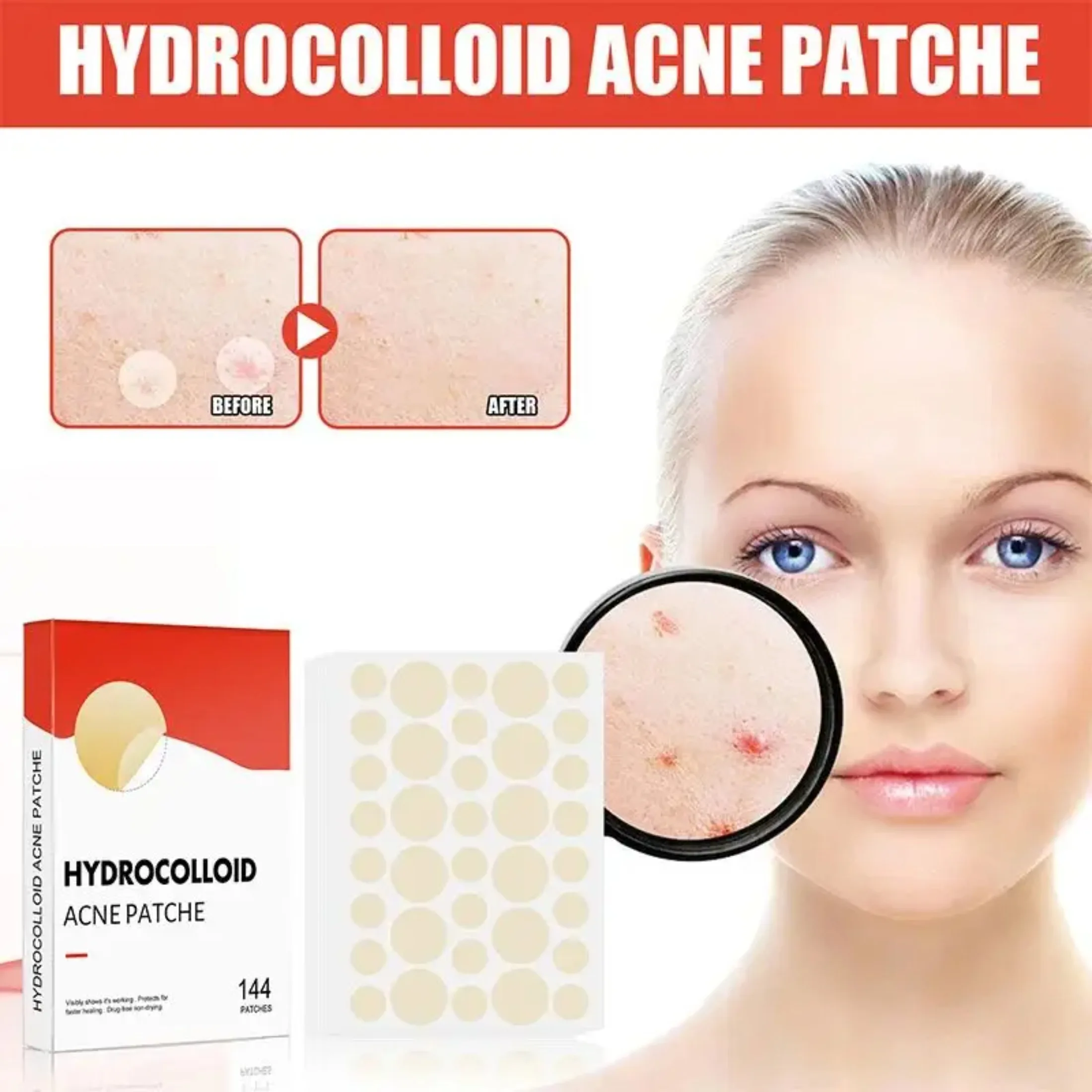 Hydrocolloid Acne Patch Invisible Closed AcnePatch Invisible Acne Face Invisible Waterproof Breathable AcneSkin Patch