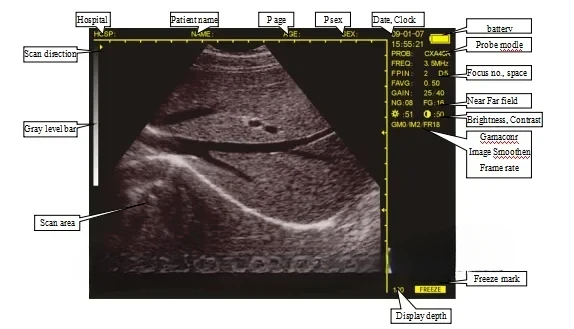 Portable Veterinary Ultrasound Cows Sheep Horse Farm Animals Professional