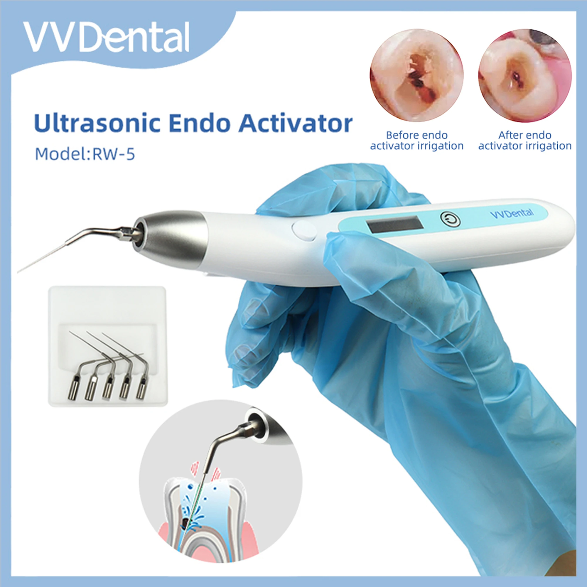 

VVDental Ultrasonic Endo Activator Sonic Irrigator With LED Light 5 Endo Files Root Canal Endodontic Cleaning Dental Endo Motor