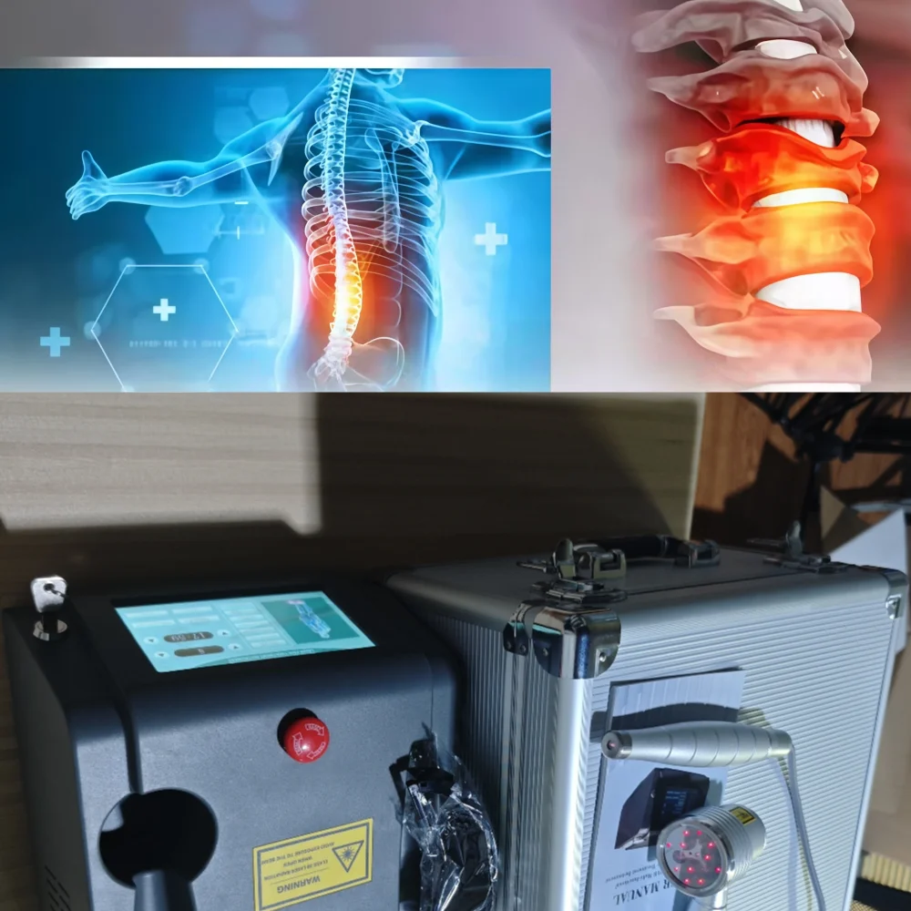 Handheld 1064nm Low Level Laser Device, All-in-One Physiotherapy for Pain Management, Soft Tissue Healing and Home Rehabilitatio
