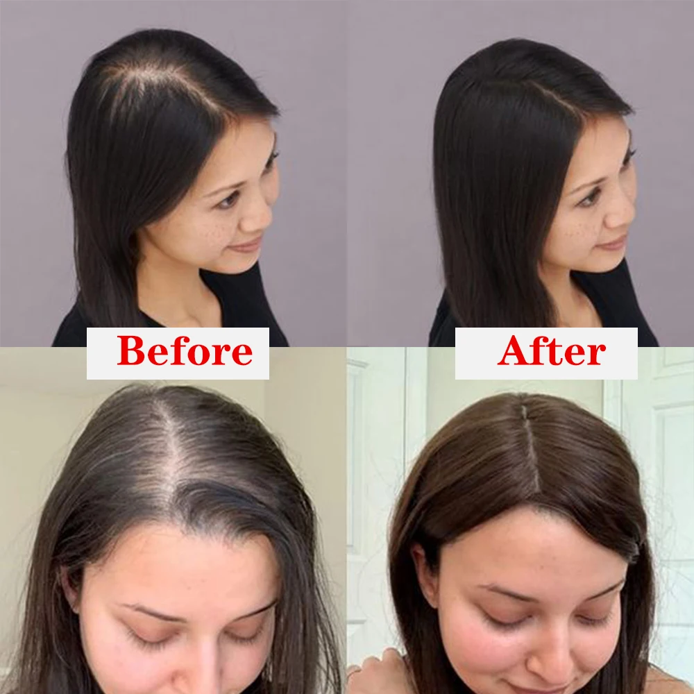 Doreen 13*15 سنتيمتر فروة الرأس توبر شعر مستعار ريمي الشعر البشري للنساء مع بولي PU الدانتيل الجلد الطبيعي الحرير قاعدة توبر كليب في الشعر اليدوية #6