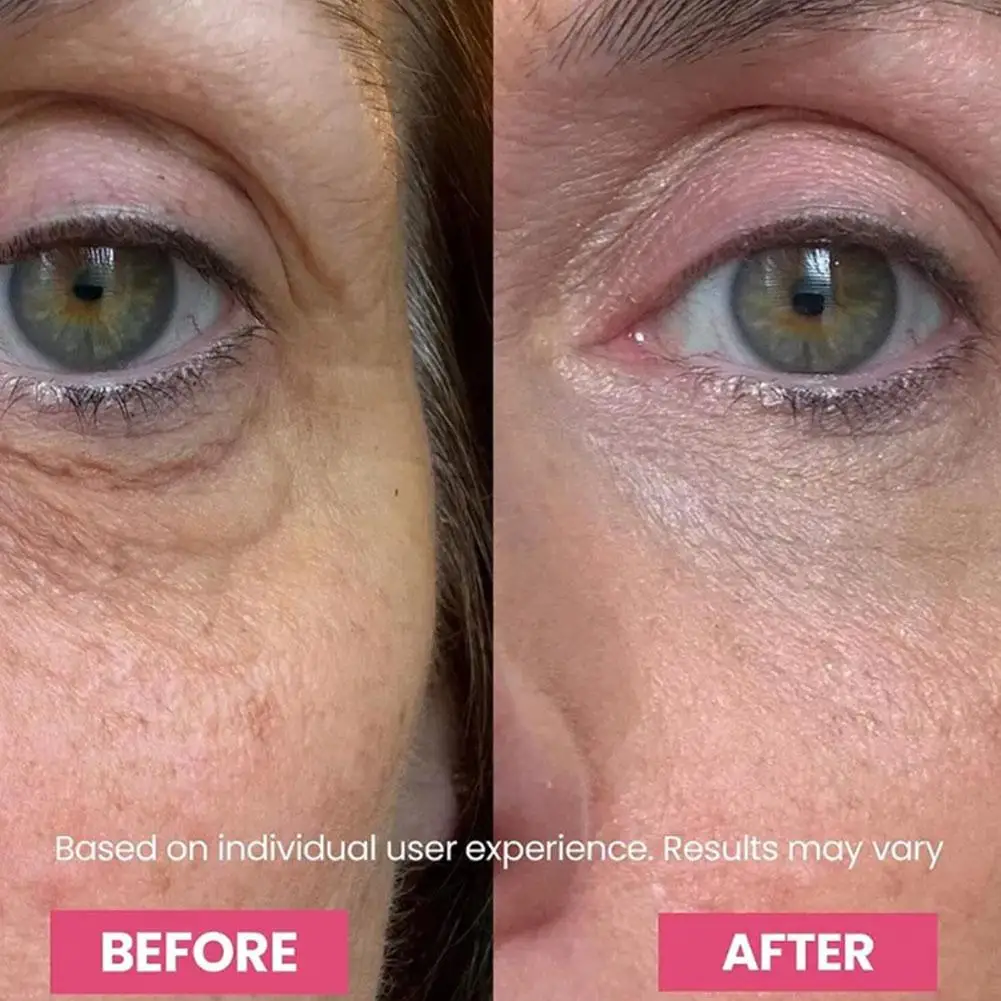 3-in-1 Multi-Balsam-Stick Luxe Koreanischer Balsam für Augen und Gesicht, Straffend & Festigend, Feuchtigkeitsspendend, Glättend, Augenpflege gegen Augenringe und Schwellungen – Detail 10