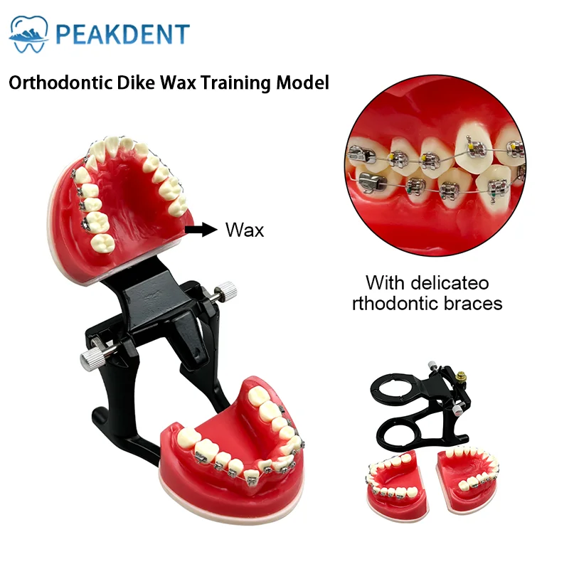 Orthodontic Typodonts Model Gum Wax Embankment Teeth Practice Model Ortho Bracket Treatment Dental Models for Teaching and Study