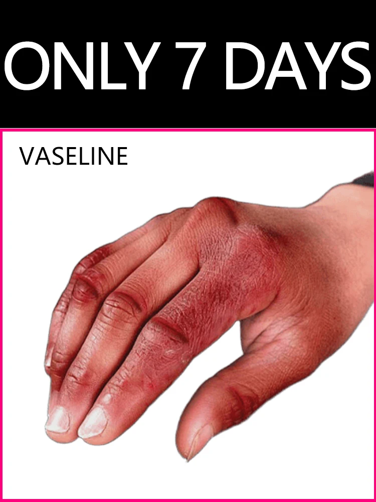

Moisturizing cream Vaseline Can be used on hands and feet Skin tools