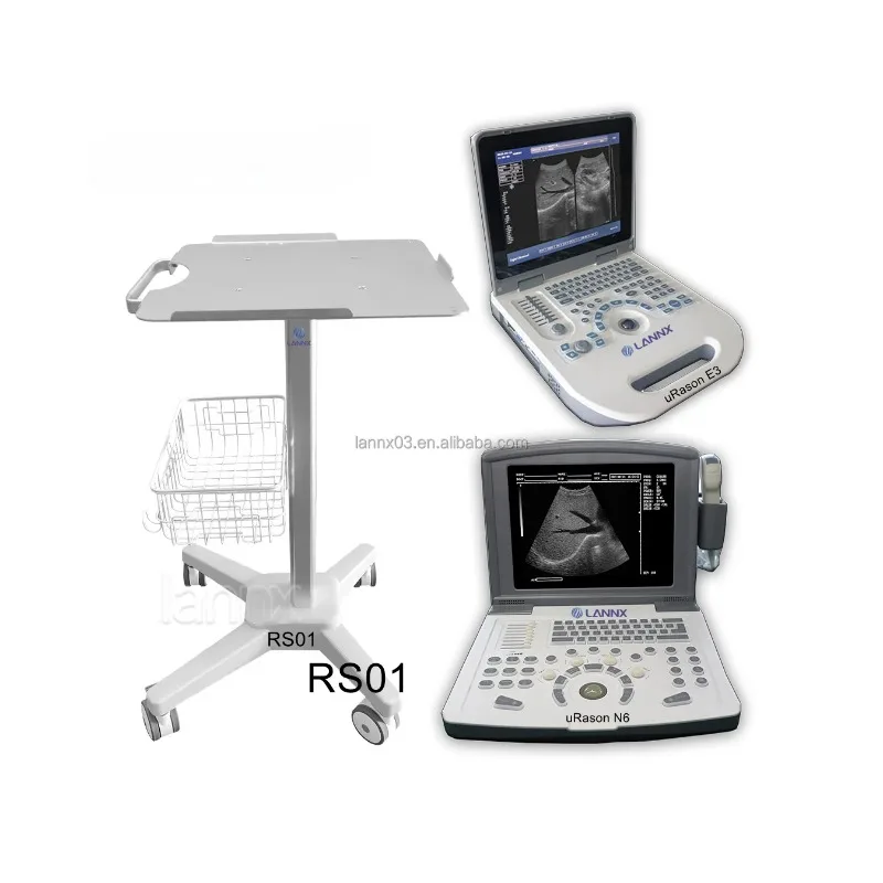 Medical Ultrasound Ultrasound Cart Color Doppler Ultrasound Diagnostic Instrument Desktop Mobile Clinic Equipment