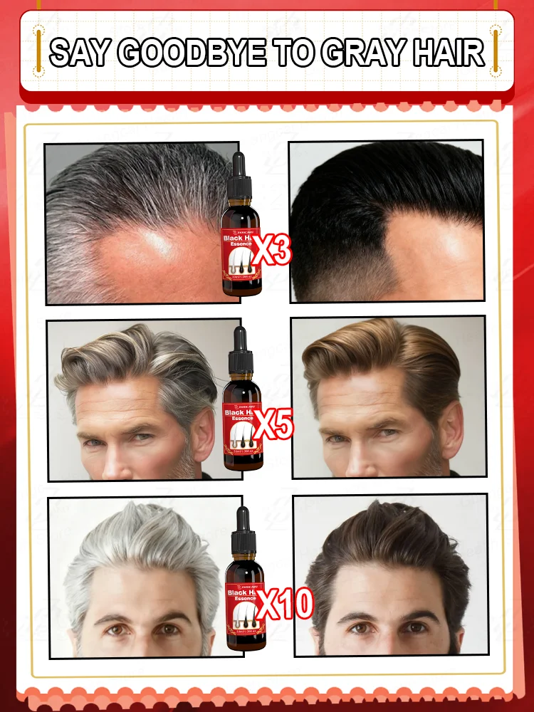 مصل الشعر المضاد للرمادي | شعر رمادي عكسي في أسابيعين! اشتر 3 واحصل على 2 مجانًا، الأكثر مبيعًا الآن #4