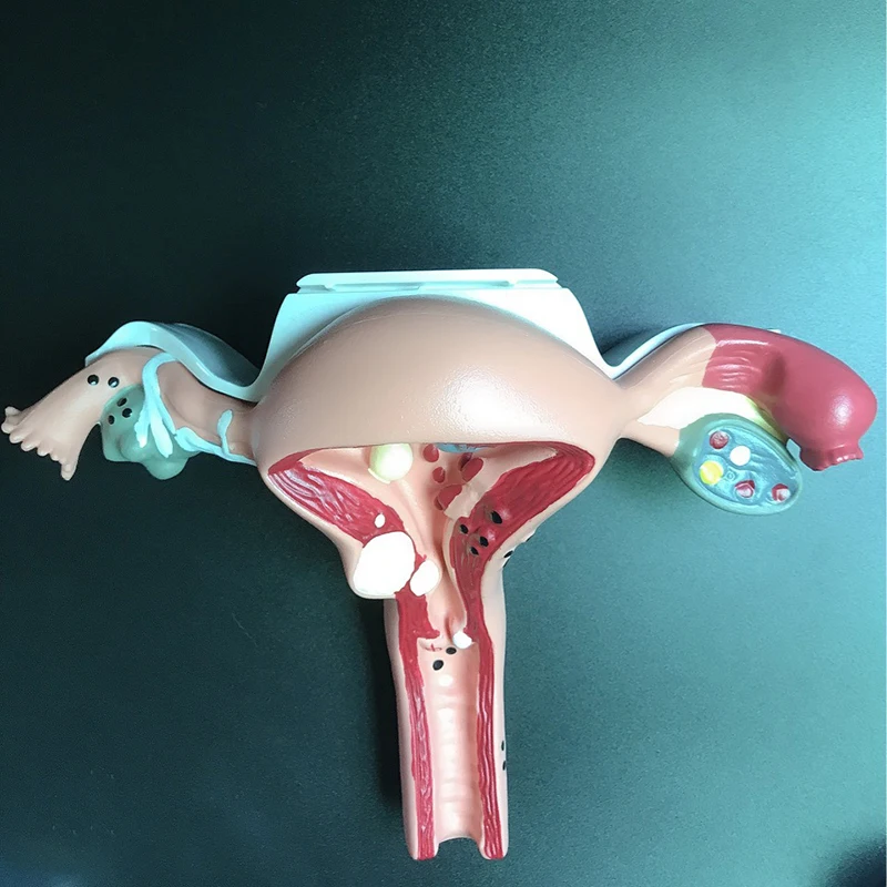 Modell der menschlichen Gebärmutter und des Eierstocks, Modell des weiblichen Fort pflanzung organs, lebensgroßes medizinisches pädagogisches