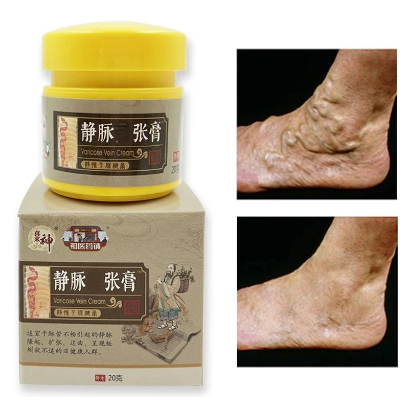 20g Varicose Vein Repair Cream Massage Soothes Puffiness Vasculitis Itching Mineral Vegetable Oil Body Private Part Skin Care