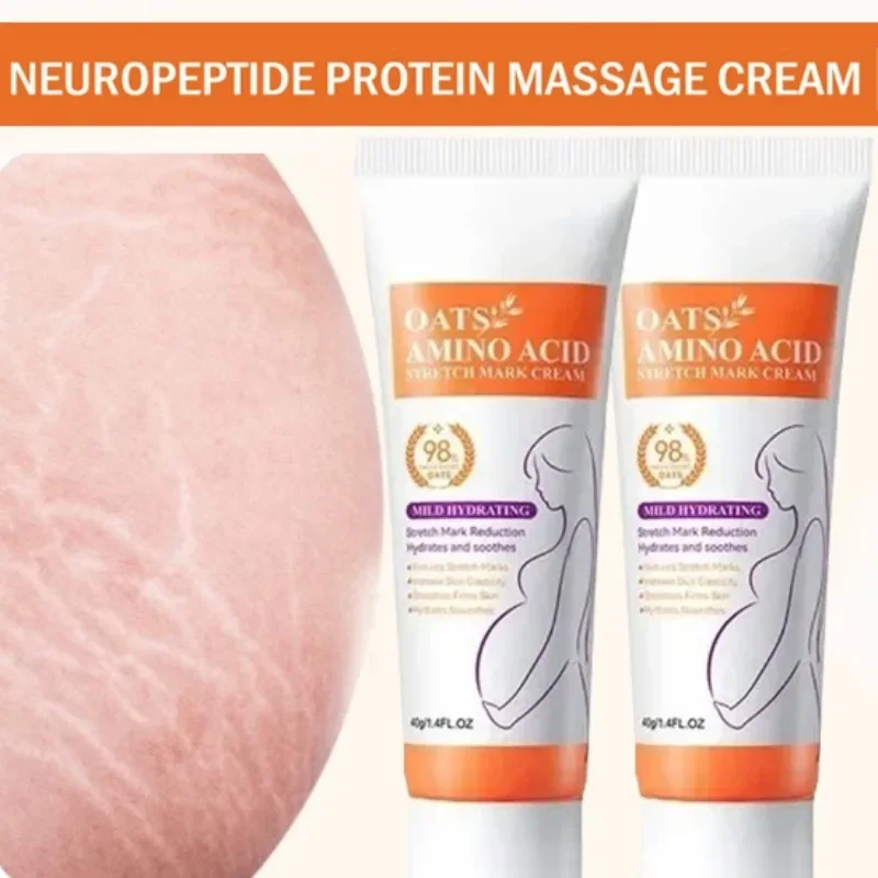7-Day Pregnancy Stretch Mark Removal Postpartum Obesity Scar-Free Body Cream for Tightening and Lifting the Buttocks