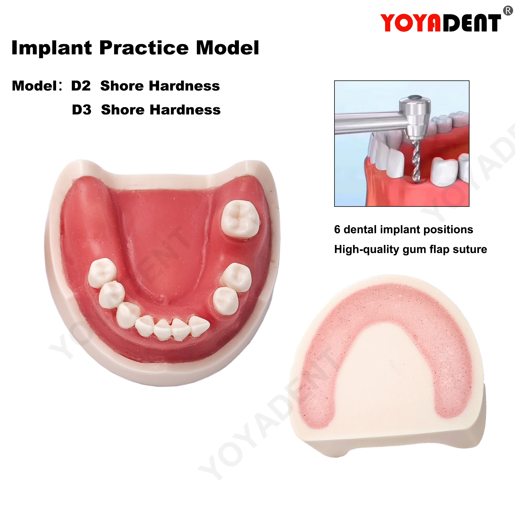 

Dental Implant Model Teeth Model For Dentistry Implant Training Gum Sutures Teaching Studying Product Dentist Material