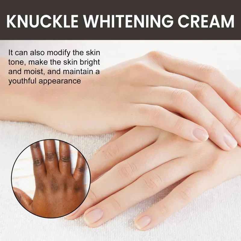 Dark Knuckles Fast Whitening Serum, Creme Anti Cracking, Corretores de pigmentação para pele negra, Removedor de manchas intensas