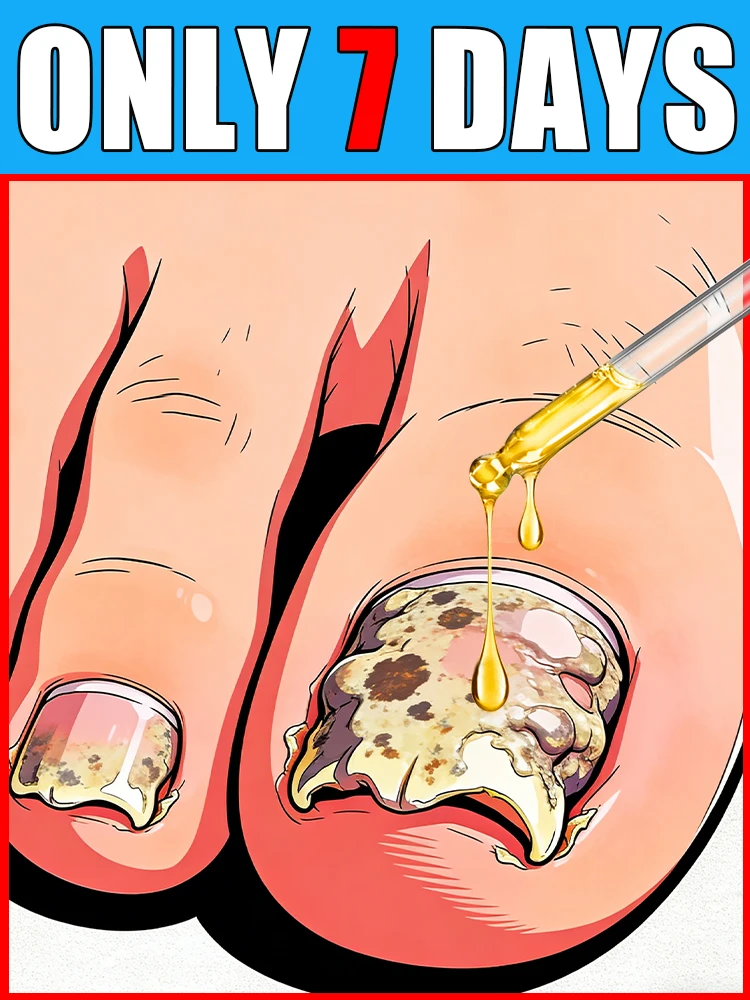 

5ᴛʜ Gᴇɴ Nᴀɪʟ Cᴀʀᴇ: Gᴇɴᴛʟᴇ & Eғғᴇᴄᴛɪᴠᴇ ғᴏʀ Fᴜɴɢᴀʟ Nᴀɪʟs