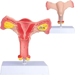 1:1 Human Female Uterus and Ovary Model Female Genital Organ Uterine Teaching Anatomical Gynecology Uterus and Ovary Model