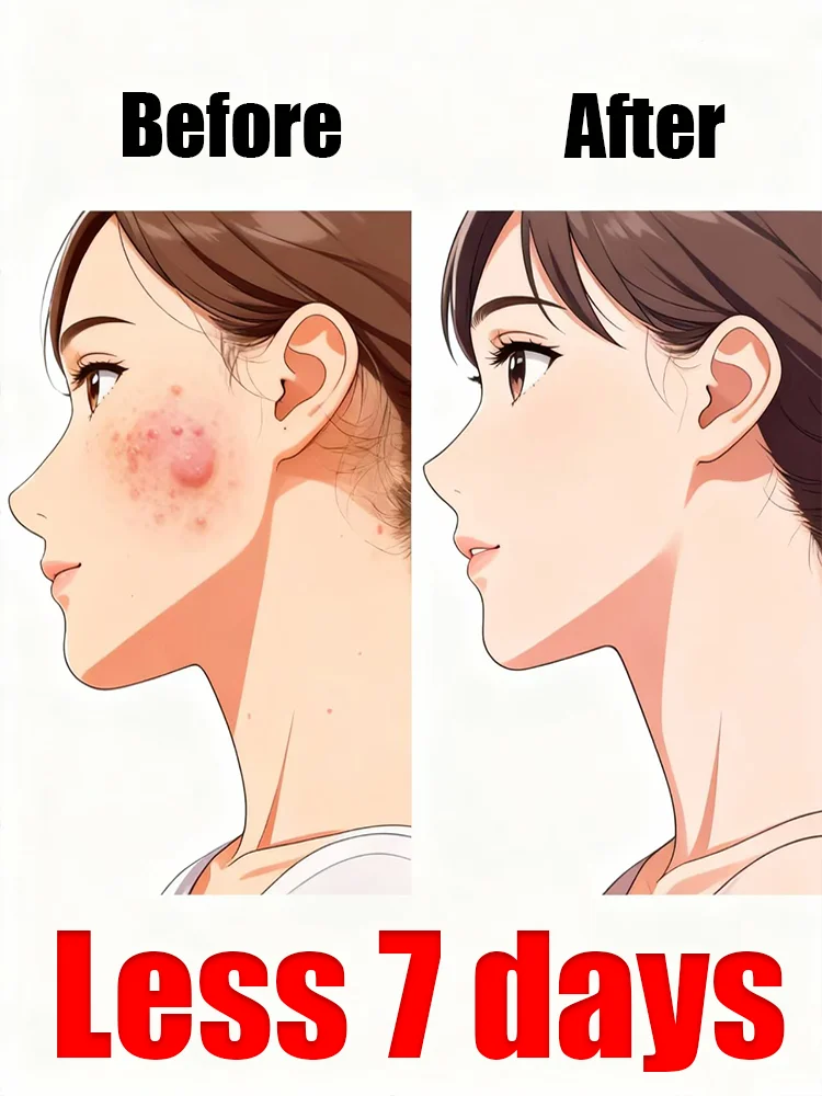 

Thoroughly clean the entire body of warts to improve discomfort and the feeling of a foreign body.