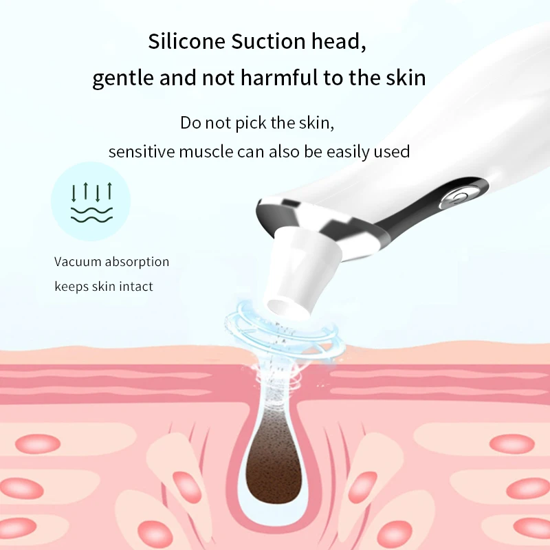 أداة إزالة الرؤوس السوداء الكهربائية البصرية لعلاج حب الشباب والبثور وإزالة الزيت والعناية الشخصية بالجمال باللون الأسود والأبيض