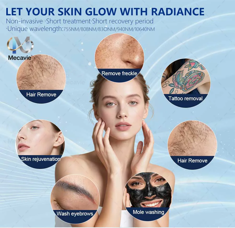 4 In 1 Soprano Titanium Ice Laser Hair Removal Device Alexandrite 808nm Diode Laser System Painless Permanent Body Hair Removal