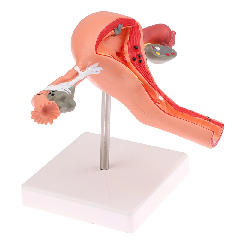 

1Pcs Props Model Pathological Uterus Ovary Anatomical Model Anatomy Cross Section Study Tool