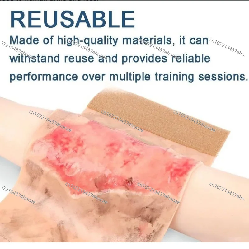 Wearable 2-3 Degree Limb Burns Training Module High Simulation Limb Burn Model Medical Student Nurse Training Model