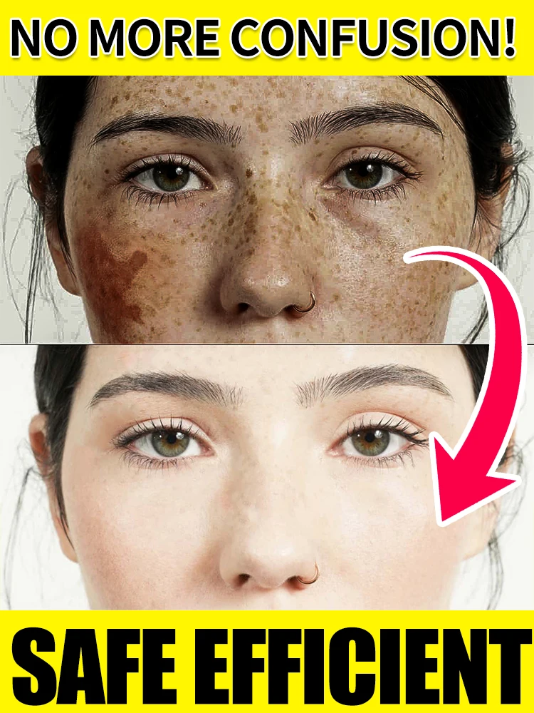 

Essence fades spots and whitens, inhibits melanin generation, evens out skin tone, improves dullness