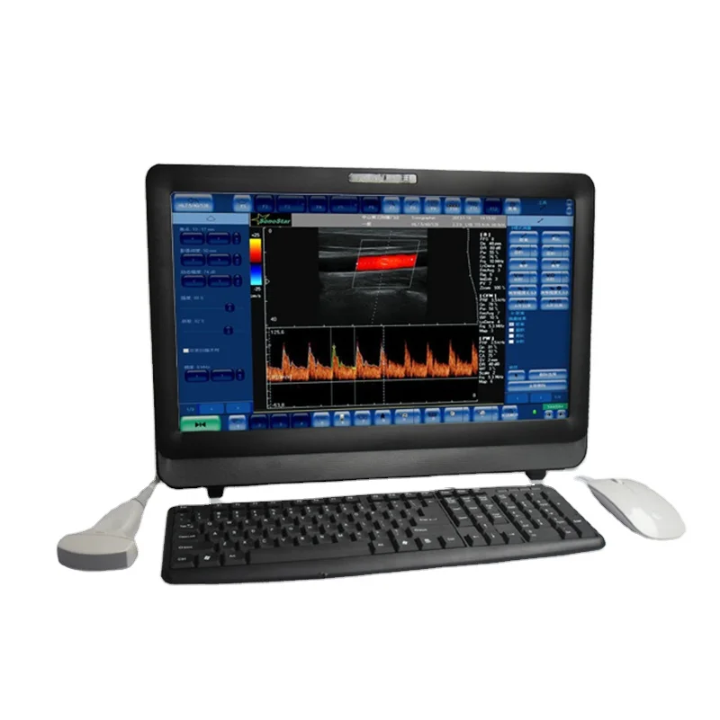 SY-A037 Hospital ultrasound machine Digital Touch on screen Multiple 12 Inch Led Medical Color Doppler